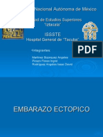 Enbarazo Ectópico