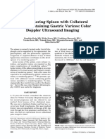 The Wandering Spleen With Collateral Vessels Containing Gastric Varices - Color Doppler Ultrasound Imaging