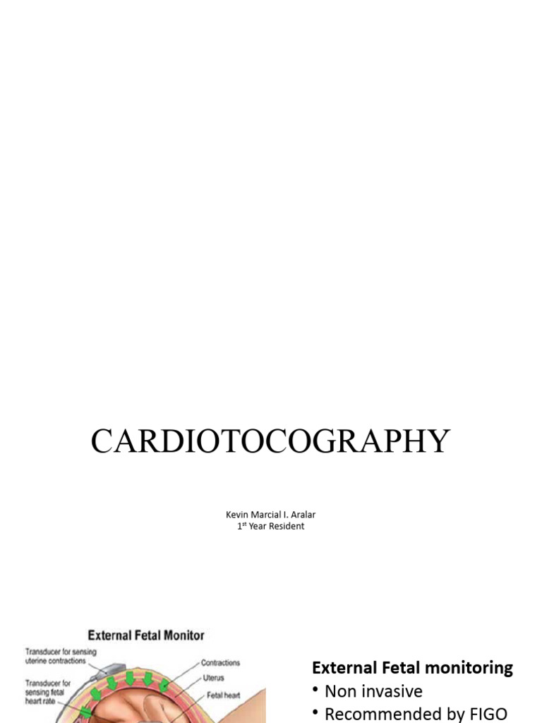 CTG Strip Interpretation Guidelines | PDF | Heart Rate | Medical ...