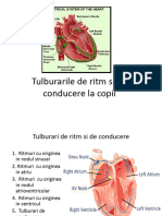 Tulburari de Ritm Si de Conducere La Copii