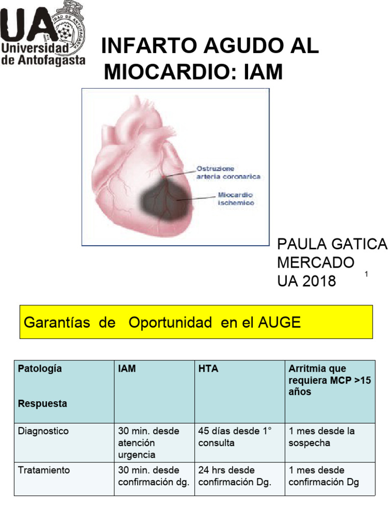 Iam 2018 PDF | PDF | Infarto de miocardio | Cardiología