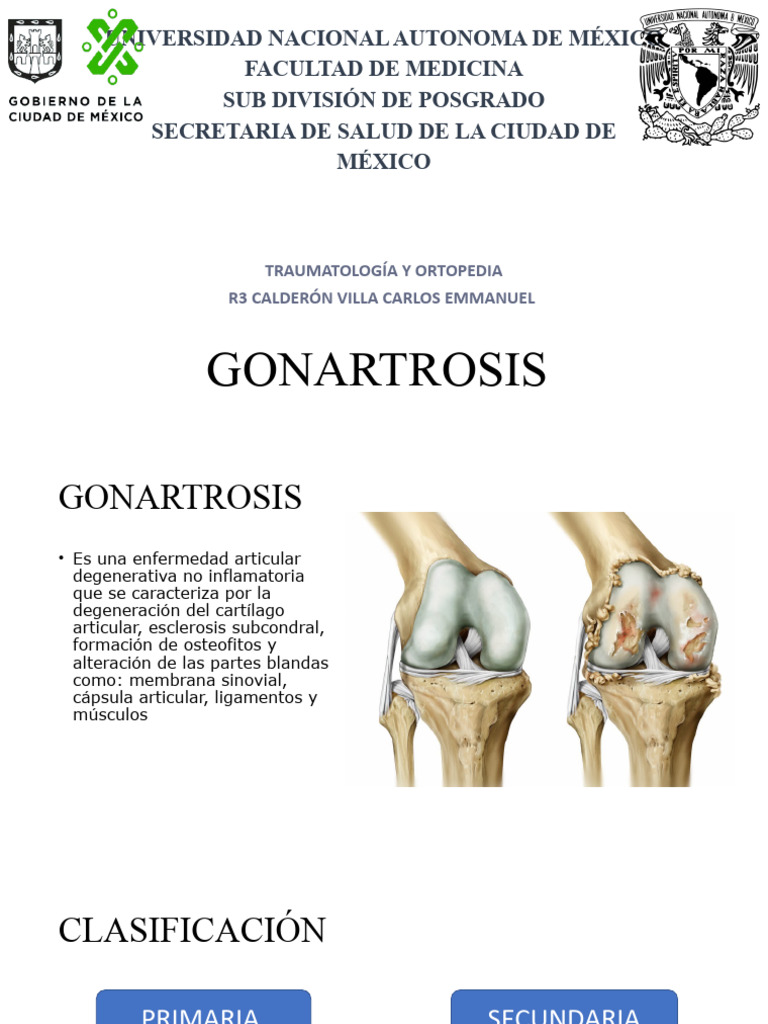 Colágeno y Gonartrosis: Aspectos Clave | PDF | Articulación | Cartílago