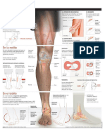 Lesiones MMII