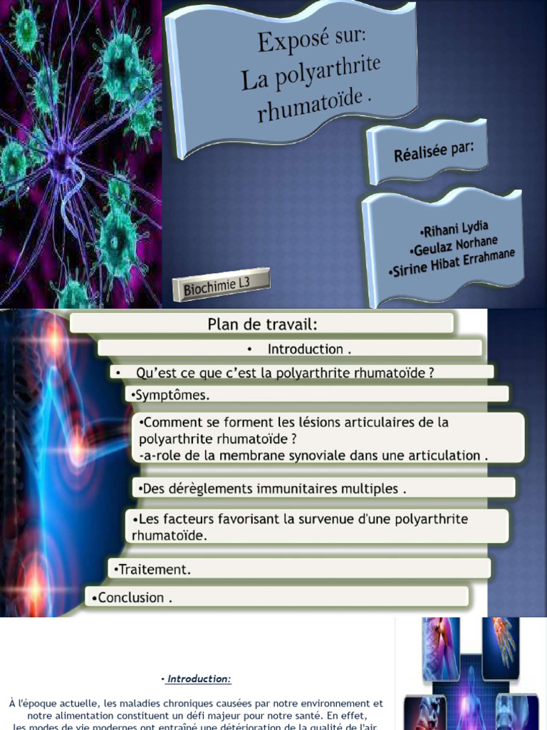 Polyarthrite Rhumatoïde : Comprendre et Agir | PDF | Polyarthrite ...