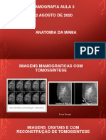 Mamografia Aula 03