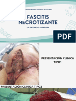 Fascitis Necrotizante: La Enfermedad Carnivora