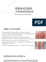 Dermatits Eccematosas
