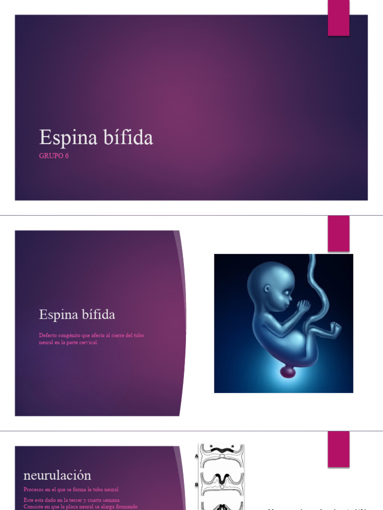 Epidemiología de la Espina Bífida | PDF | Enfermedades y trastornos ...