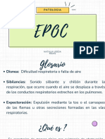 Epoc