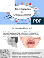 Adenoidectomia Orl