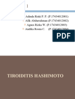 Tiroiditis Hashimoto