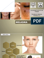 MELASMA