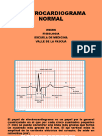 Electrocardiograma Normal