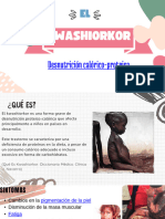 Presentacion Nutricion Kwashiorkor