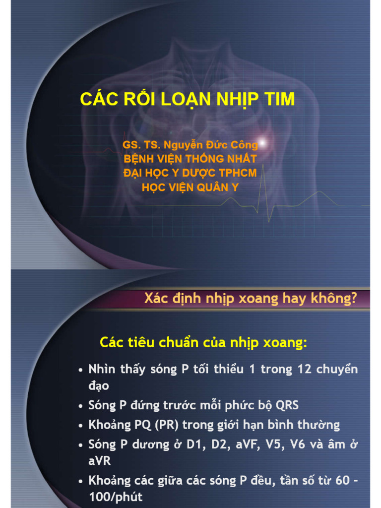 ECG CÁC RỐI LOẠN NHỊP TIM (Compatibility Mode) | PDF