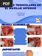 Tecnicas de Anestesia Mandibular | PDF | Diente | Boca