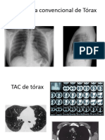 Tema 16-17 - Radiologia Del Torax