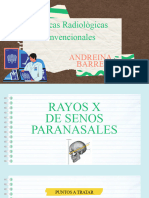 Rayos X de Senos Paranasales