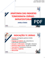 2.1.1 Tomografia Crânio Janela Óssea