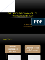 Tumores de Pancreas