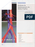 04 - Síndrome de Aprisionamento Da Artéria Poplítea - Compressed