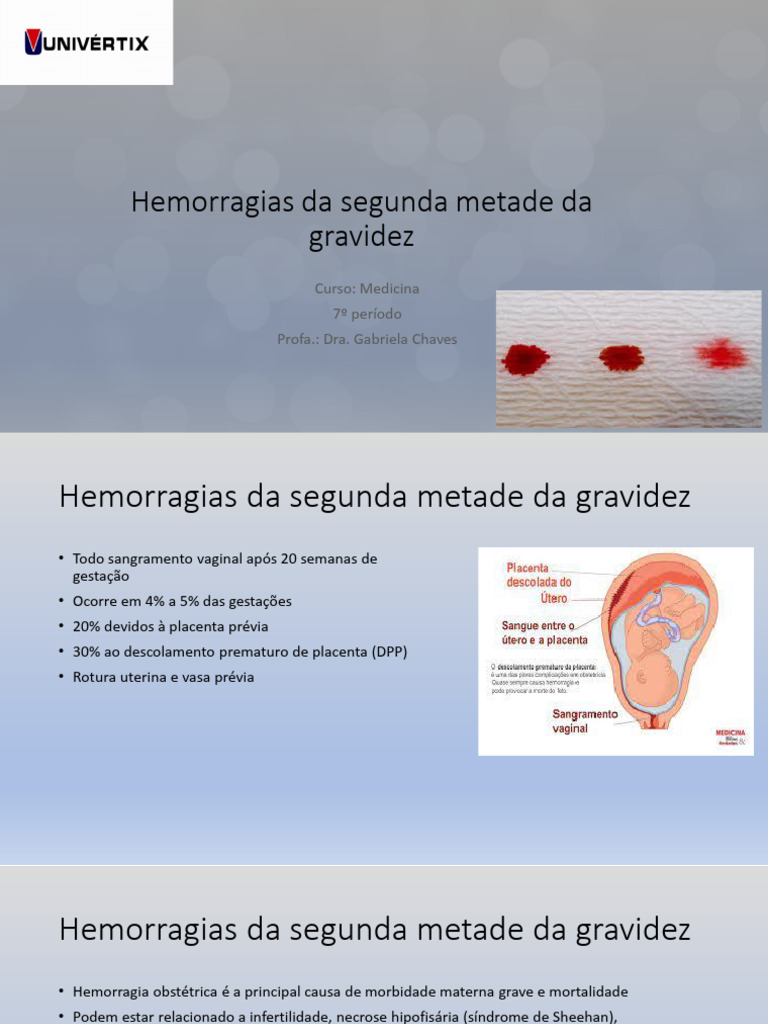 Hemorragias na Gravidez Tardia: Causas e Tratamento | PDF | Placenta ...