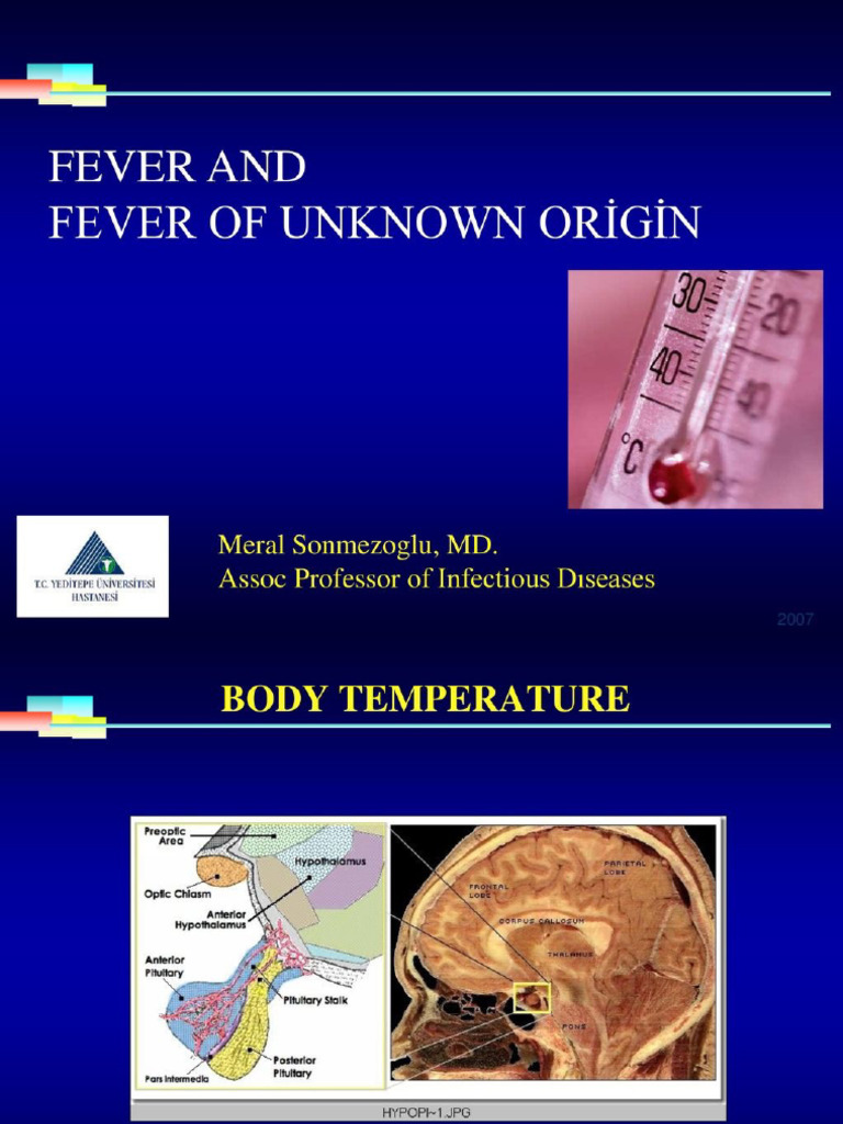 Unknown Origin of Fever | PDF