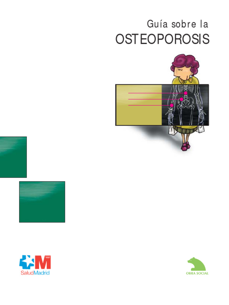 Osteoporosis consejos | PDF | Osteoporosis