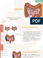 Intussusception PDF