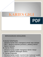 Karies Gigi