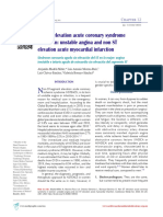 Non ST Elevation Acute Coronary Syndrome in Women - Unstable Angina and Non ST Elevation Acute Myocardial Infarction