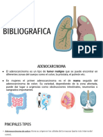 REVISION BIBLIOGRAFICA Adenocarcinoma