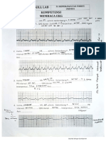 Ekg 1