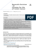 Complete Mesocolic Excision and Extent of Lymphadenectomy For The Treatment of Colon Cancer