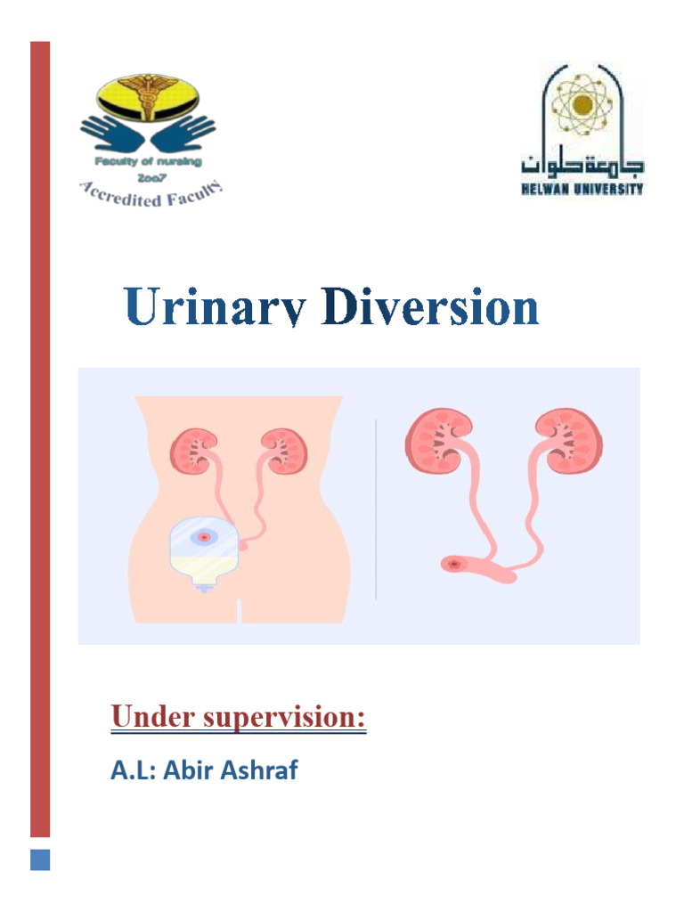 Urinary Diversion Download Free PDF Urinary Incontinence Organ