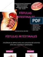 Fistulas Intestinales - PPTX (Reparado)