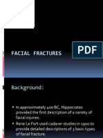 Facial Fractures 2