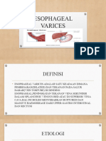 Esophageal Varices