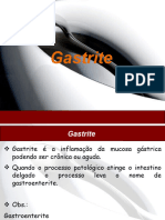 Gastrite