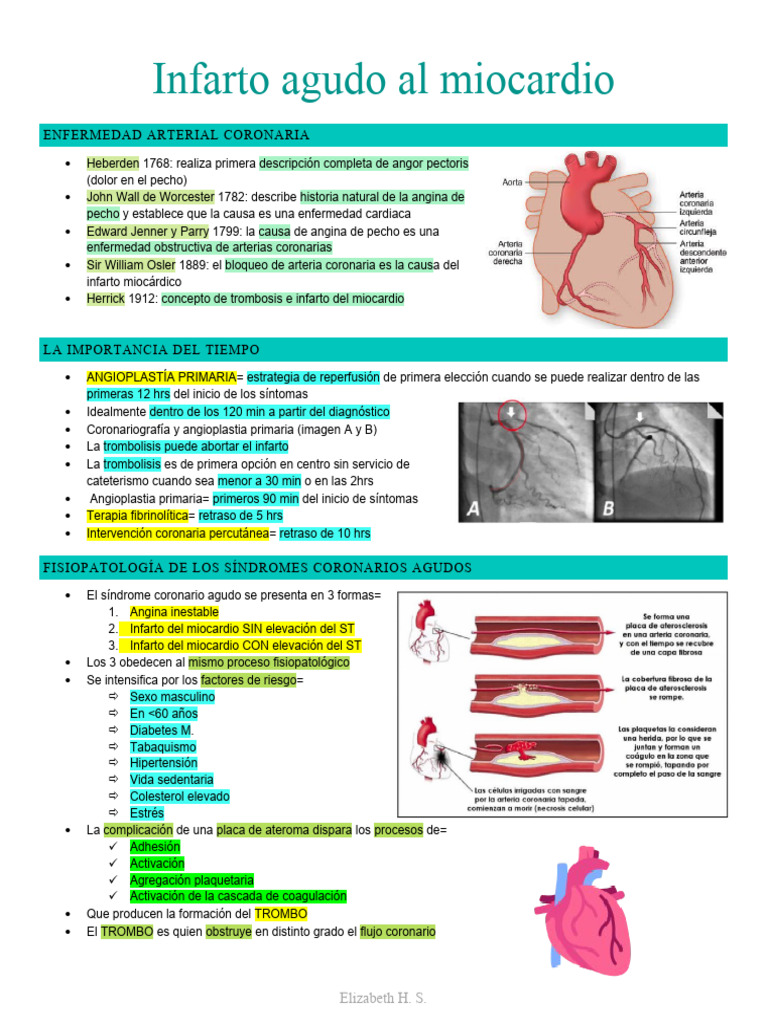 Infarto Agudo Al Miocardio Curso | PDF | Infarto de miocardio ...