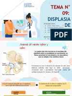 Tema #09 - Displasia de Cadera