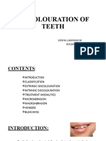 Discolouration of Teeth