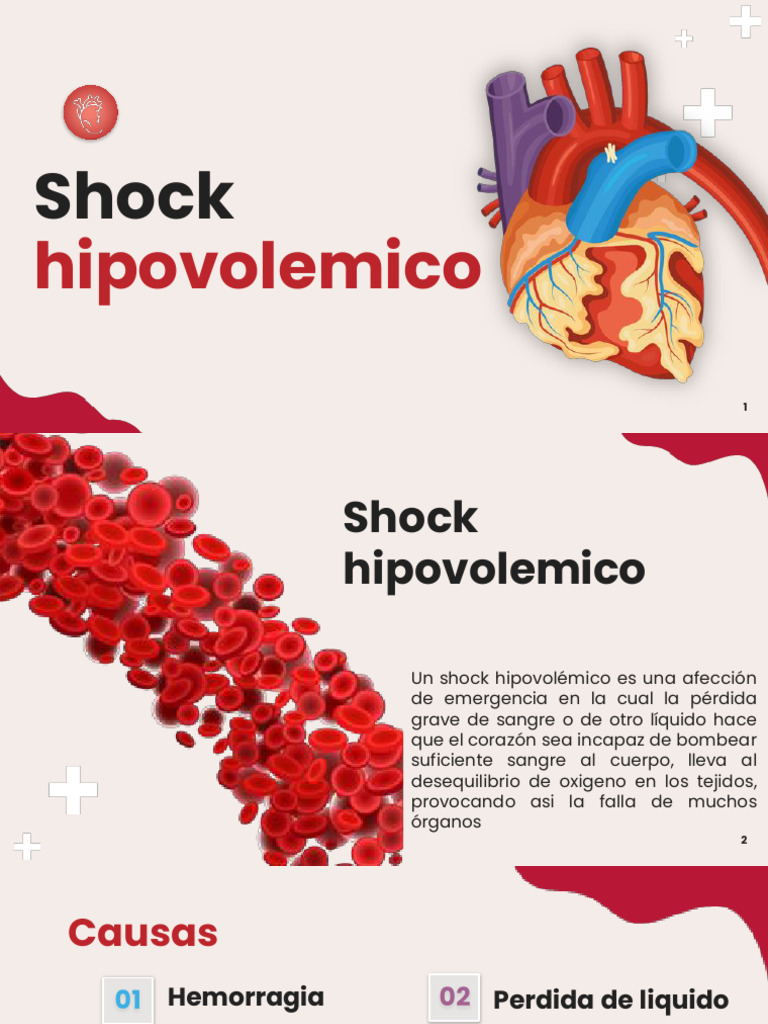 shock hipovolemico | PDF | Fisiología | Emergencias Médicas