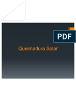 Queimadura Solar