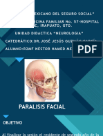 Paralsis Facial