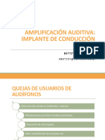 Tema 11 - Implante de Conducción Ósea