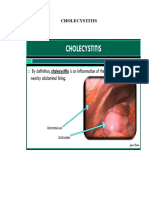 Cholecystitis