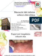 Mucocele