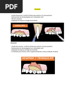 Tipos de Retalhos em Odontologia | PDF