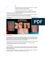 Artritis Psoriásica